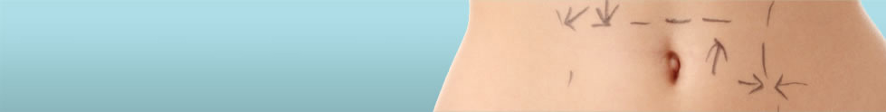 Tummy Tuck