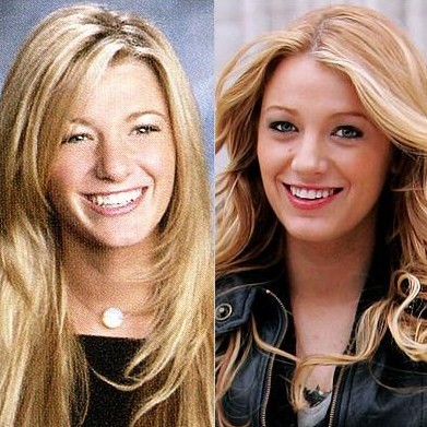 Blake Lively Plastic Surgery on Blake Lively To Star In Affleck S The Town   Plastic Surgery Channel