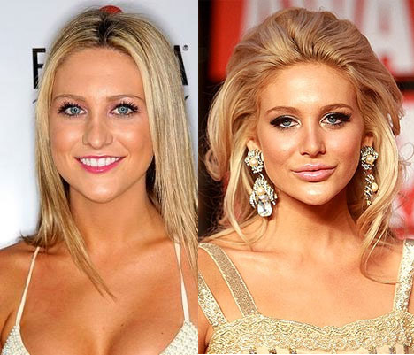 http://www.theplasticsurgerychannel.com/wp-content/uploads/2009/09/Stephanie-Pratt-before-and-after.jpg