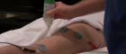 Non-surgical fat removal
