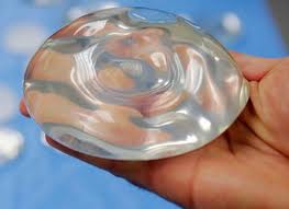 Sientra-Breast-Implant