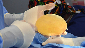 Form stable breast implant