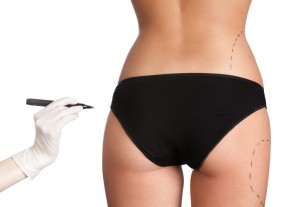 Butt Augmentation Atlanta GA