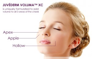 juvederm_voluma_xc_banner