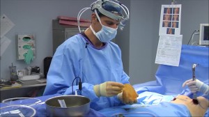 Textured Implants and Capsular Contracture