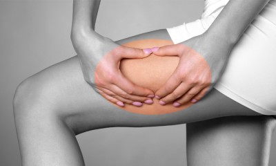 Woman examining cellulite on her leg.