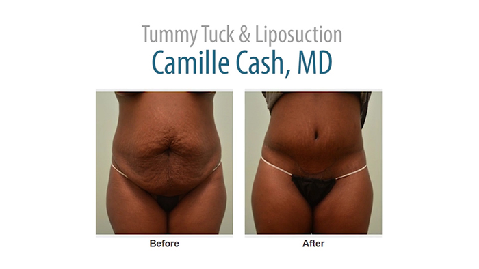 cash-mommymakeover.00_00_51_04.Still002