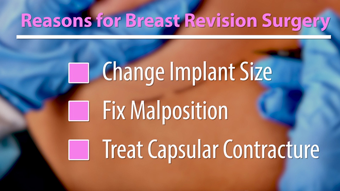 Reasons for breast augmentation revision.