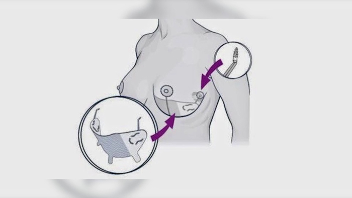 internal bra diagram