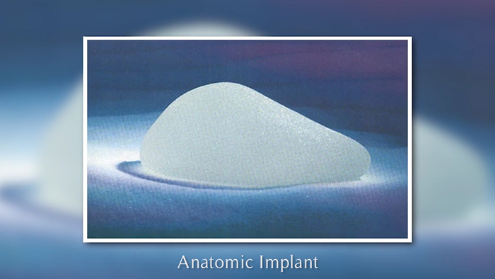 shaped breast implant