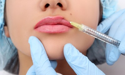 Volbella lip injections