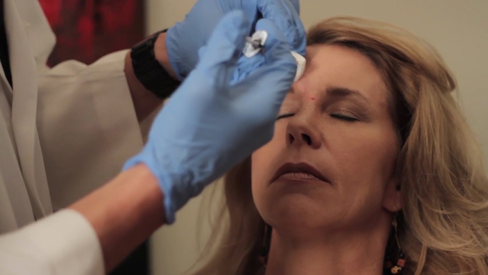 woman receives a Botox injection