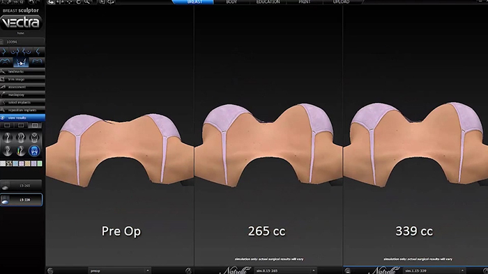 Vectra 3D imaging.