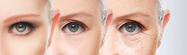 Blepharoplasty, or eyelid surgery