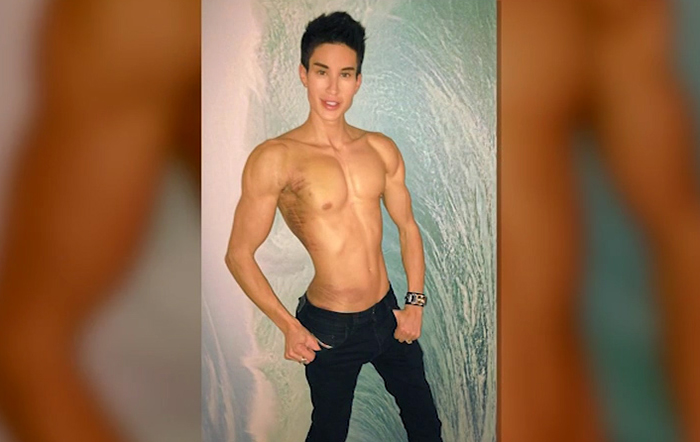 justin jedlica plastic surgery addiction