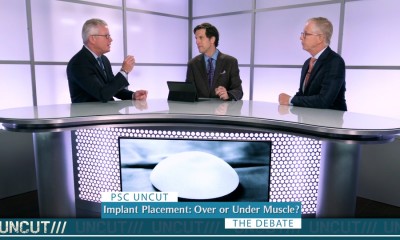 breast implant position psc discussion