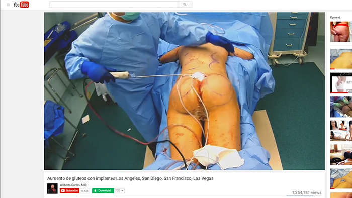 Live streamed surgery.