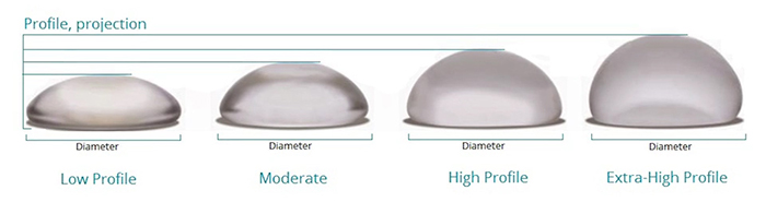 Breast augmentation implant types.