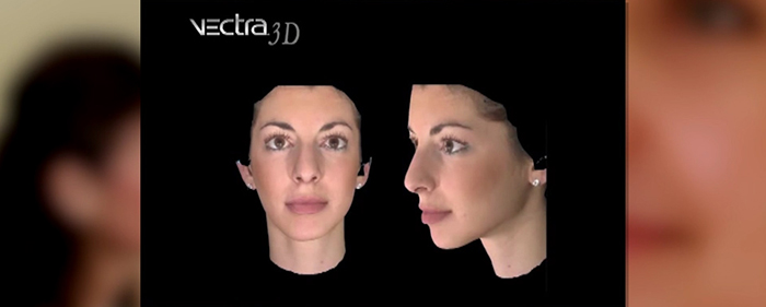 3D imaging and rhinoplasty.