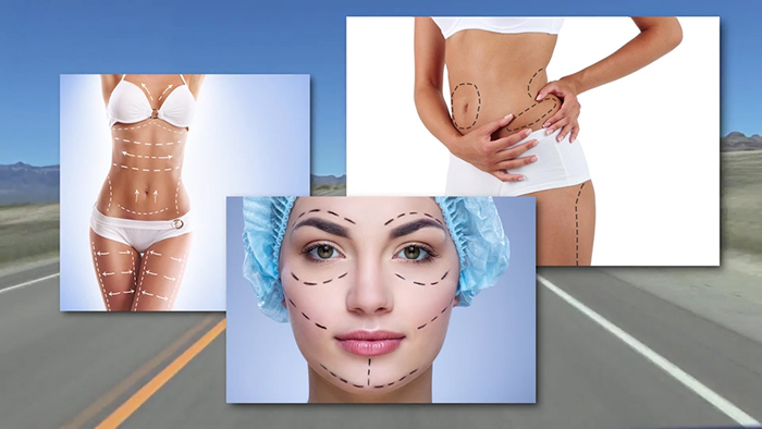 Cosmetic surgery is popular.