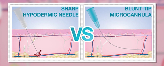 Blunt-tipped micro cannula for facial fillers.