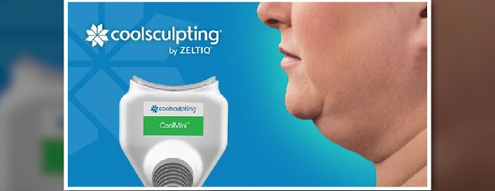 Freezing fat in the neck with CoolSculpting mini.
