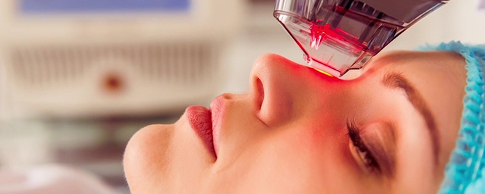 Facial rejuvenation - #4 resurfacing.