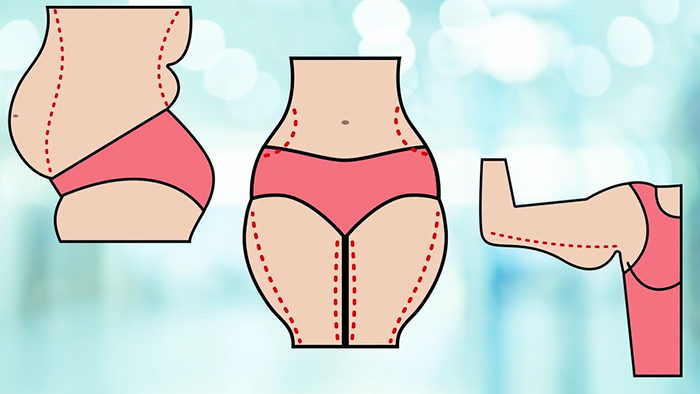 Body contouring options.