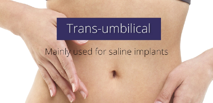 Incision options - trans-umbilical.