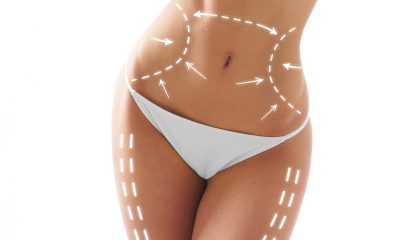 Body contouring with the body plan.
