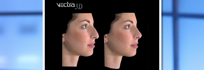 Using 3D imaging to devise a plan.