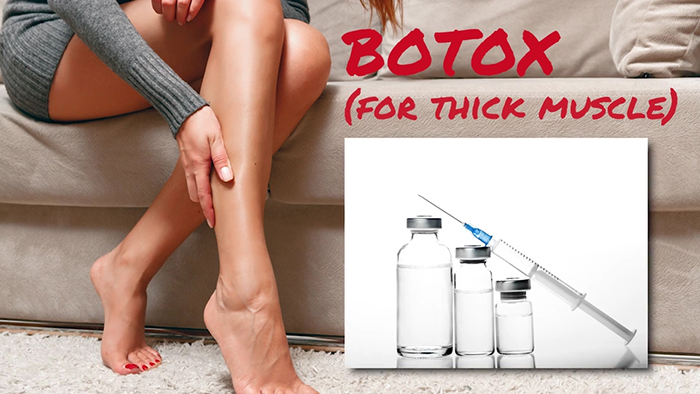 Botox and cankles.