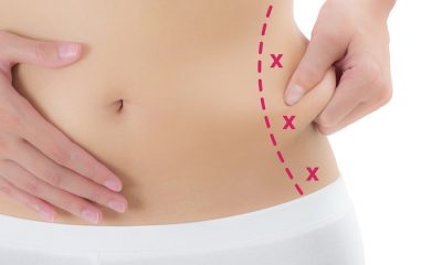 The SKINNY: Why Liposuction Works Great For Fit Bodies