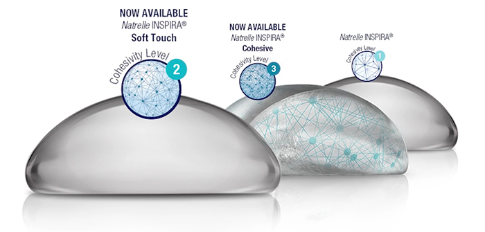 Differences between SoftTouch and other implants.