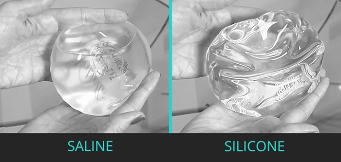 Saline vs. silicone breast implants.
