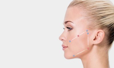 The Silhouette Lift - A non-surgical facelift alternative.