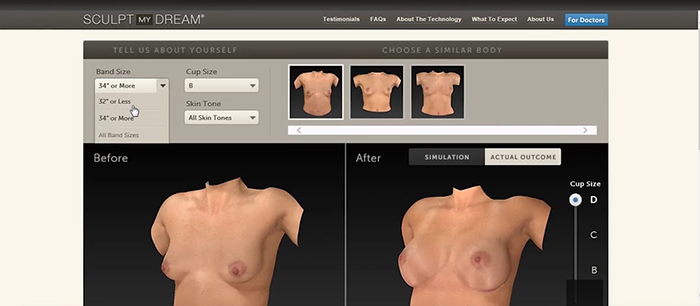 Vectra 3D imaging for a natural looking breast.