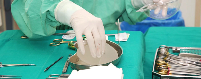 Breast Implant-Related illness - a matter of surgical skill.