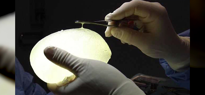 Runny gel in older breast implants.