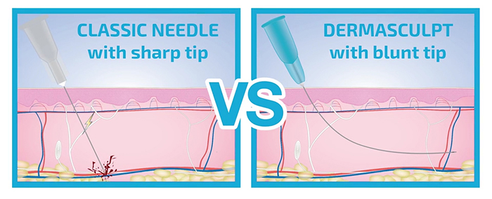 Blunt cannulas vs. needles.