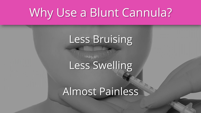 The benefits of using cannulas for injections.