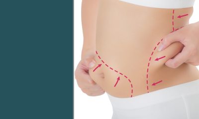 What's new in liposuction?