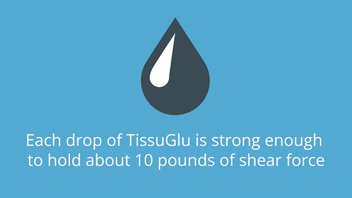 Improved tummy tuck - TissuGlu.