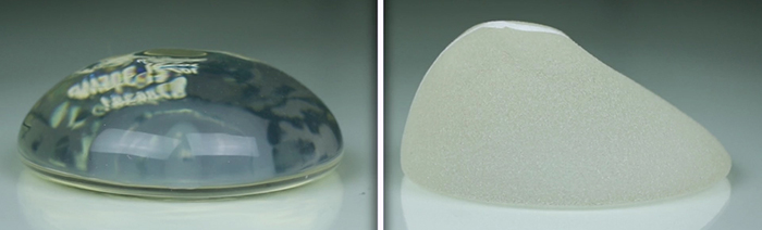 Modern Implants: Shaped Vs. Round.