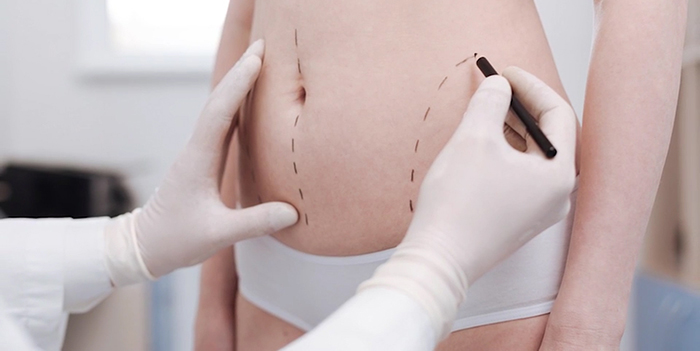 non-surgical body contouring.