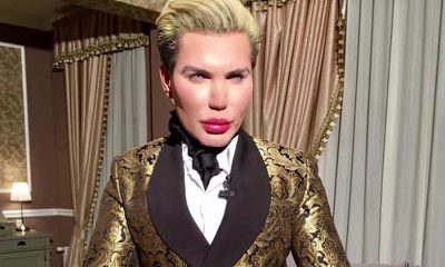 Rodrigo Alves, the Extreme End of Plastic Surgery.