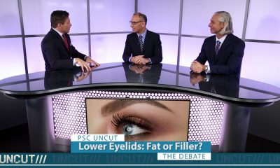 Fat Grafting or Fillers for Lower Eyelid Rejuvenation.