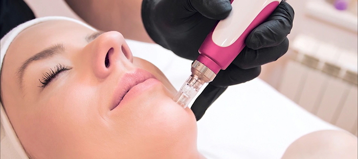 Energy-based microneedling.