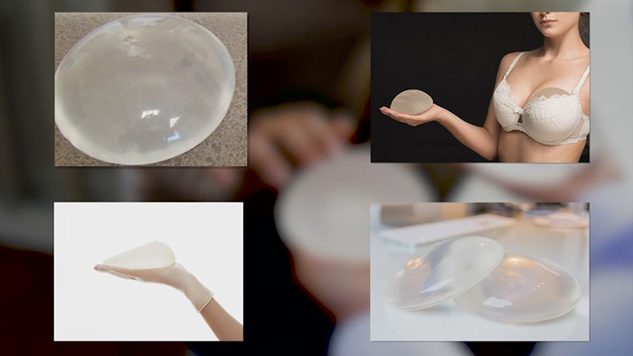 Breast implants - saline or silicone.