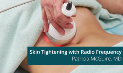 Skin tightening with the ThermiRF devices.